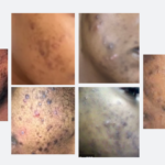 Read more about the article Isichitho