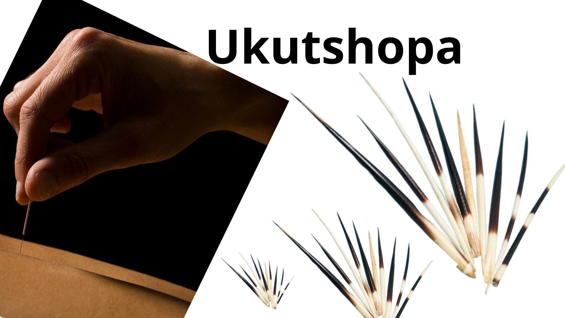 You are currently viewing <strong>Ukutshopa – African acupuncture therapy</strong>