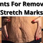 Read more about the article Plants for removing stretch marks