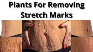 Read more about the article Plants for removing stretch marks
