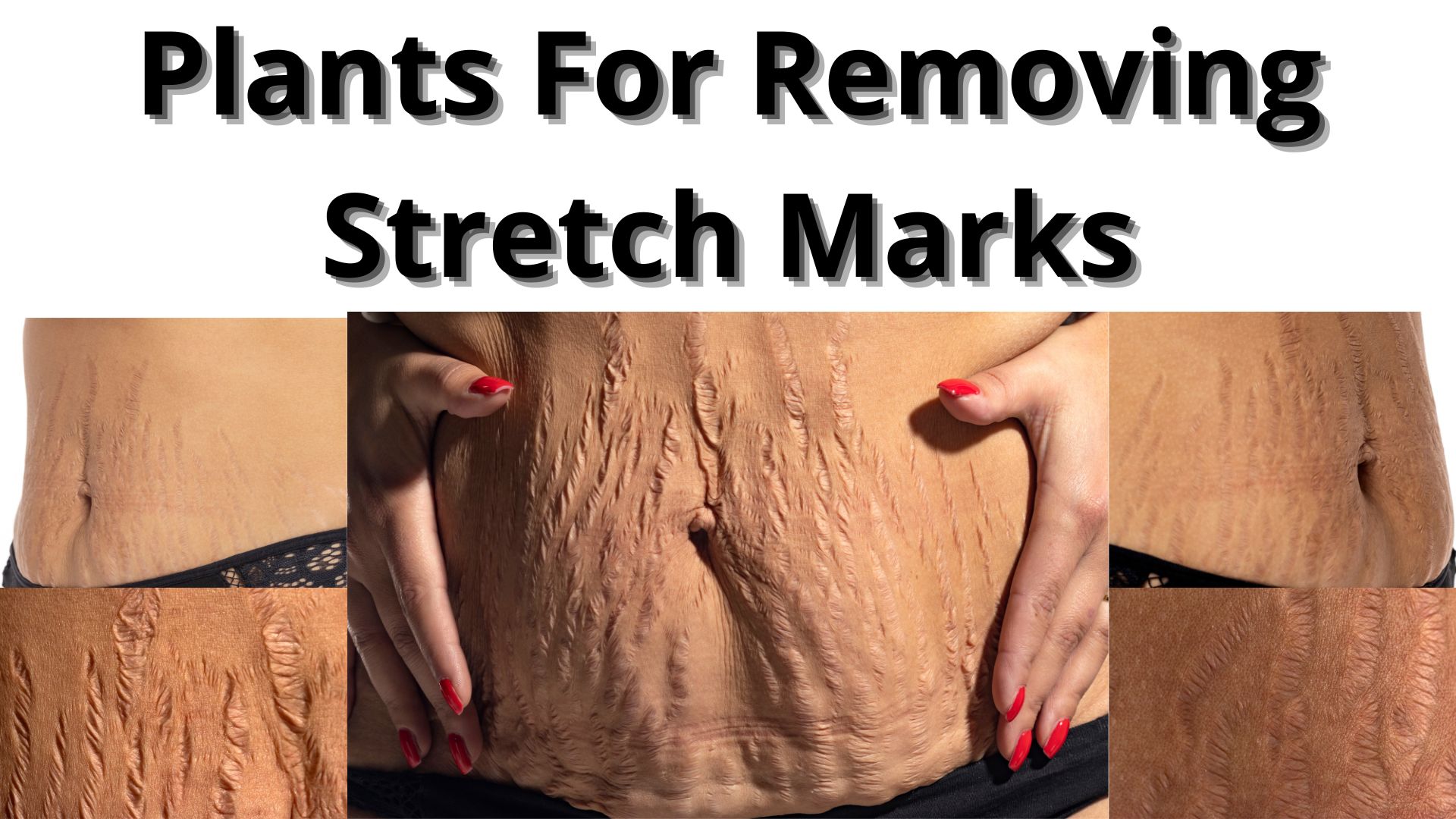 You are currently viewing Plants for removing stretch marks