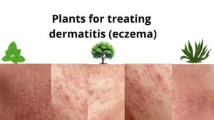 Read more about the article Plants for treating atopical dermatitis (eczema)