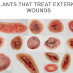 PLANTS THAT TREAT WOUNDS